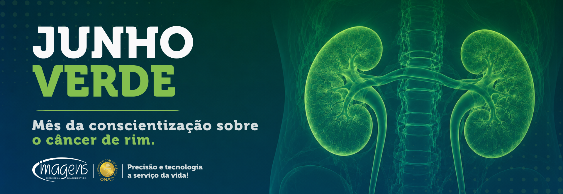 Abril Verde